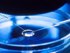 Read more about the article Role of IVF at Treating Unexplained Infertility?