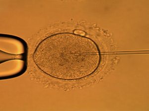 Read more about the article Intracytoplasmic Sperm Injection (ICSI)