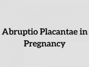 Read more about the article Watch out for Abruptio Placantae in Pregnancy