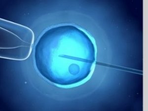 Read more about the article How much do you know about Intracytoplasmic Sperm Injection (ICSI)?