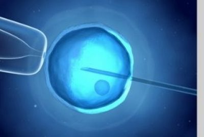How much do you know about Intracytoplasmic Sperm Injection (ICSI)?