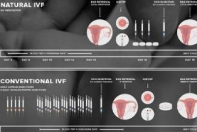 Differences between Natural IVF cycle and Conventional IVF Cycle