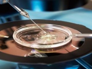 Read more about the article IVF Treatment: Understanding the Success Rate Deciding Factors
