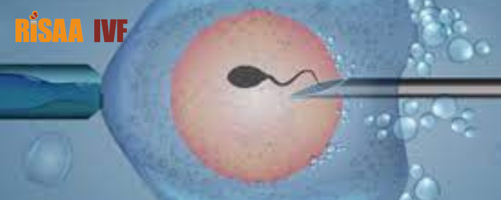 IVF Treatment: Understanding the Success Rate Deciding Factors