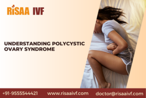 Read more about the article Understanding Polycystic Ovary Syndrome
