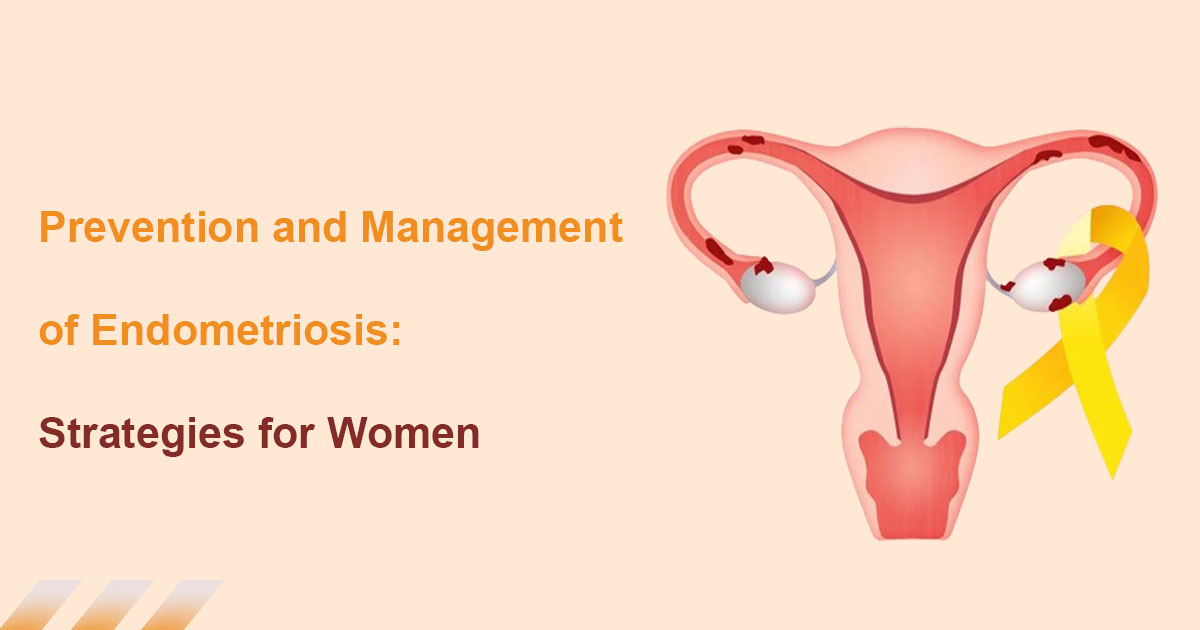Prevention and Management of Endometriosis: Strategies for Women