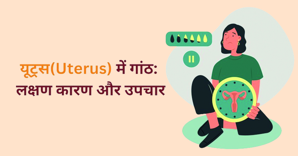 यूट्रस(Uterus) में गांठ: लक्षण कारण और उपचार