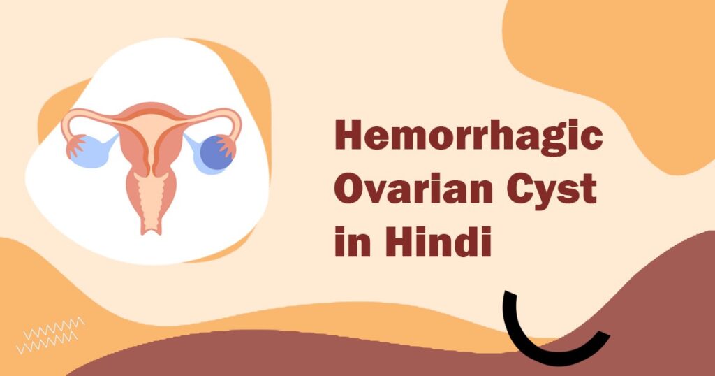 Hemorrhagic Ovarian Cyst in Hindi