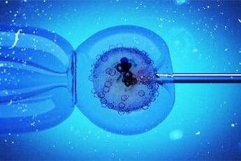 Pre-implantation Genetic Diagnosis