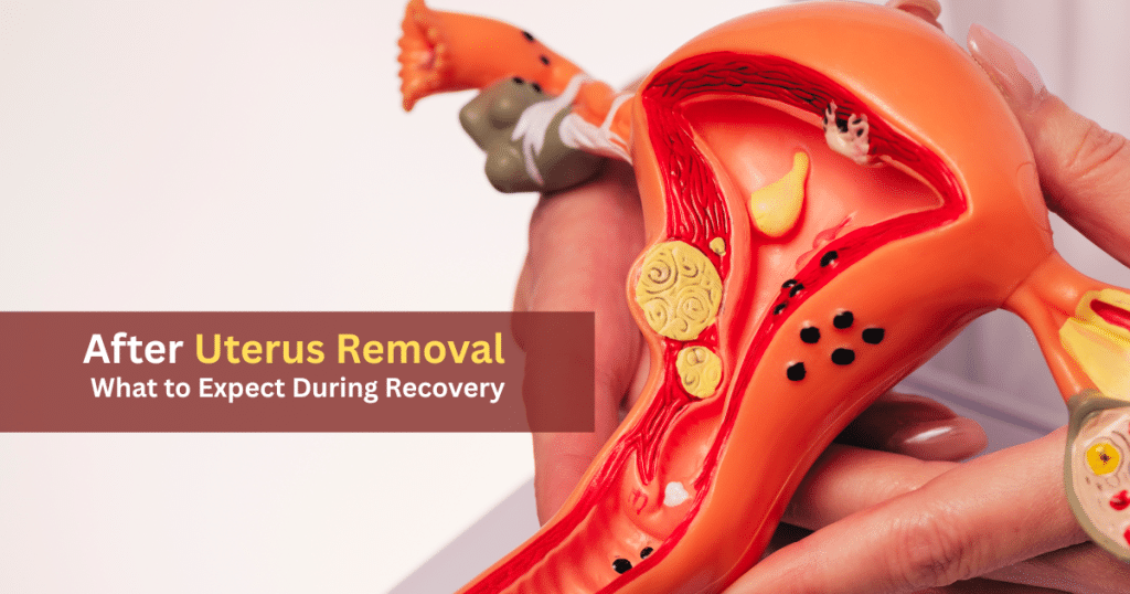 after uterus removal