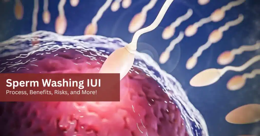 Sperm Washing IUI