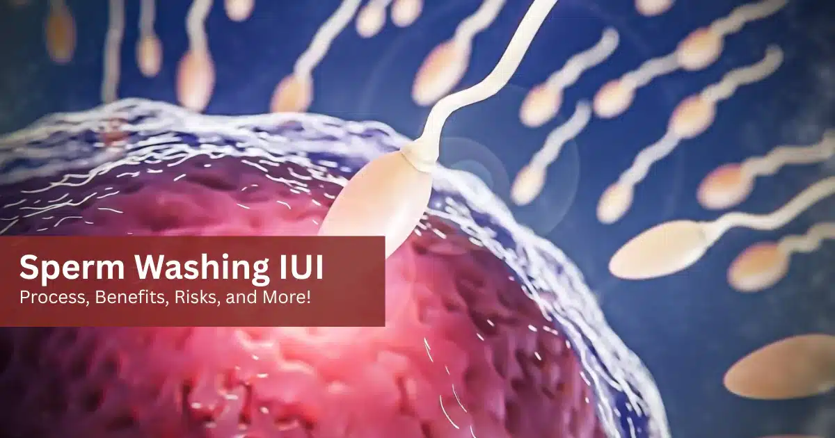 Sperm Washing IUI
