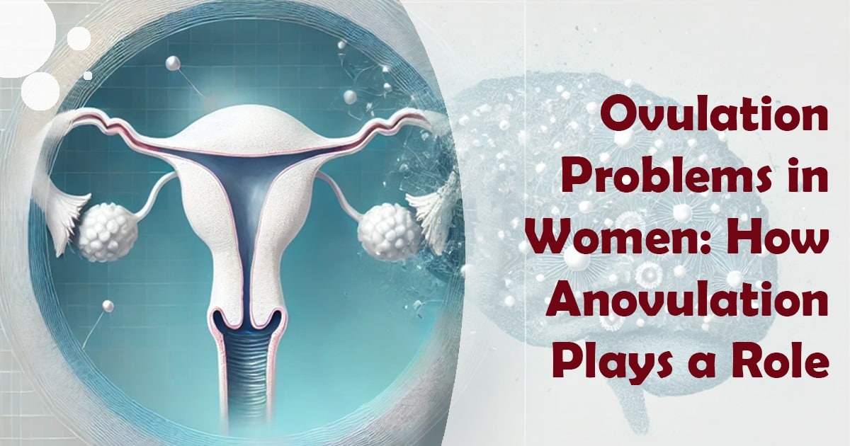 Ovulation Problems in Women