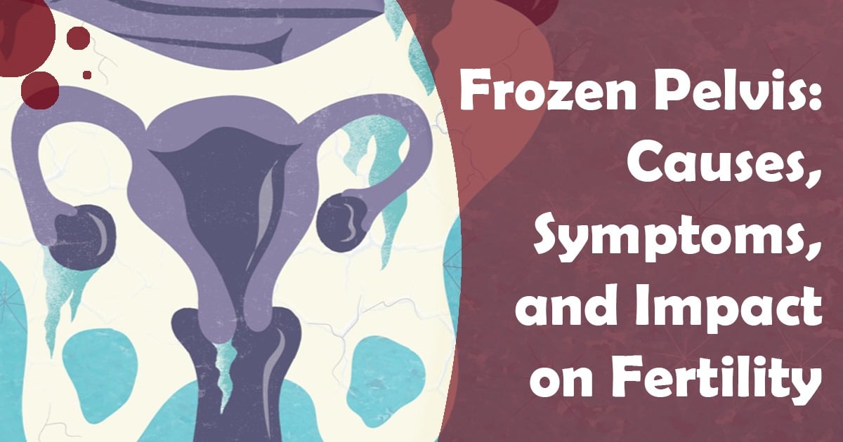 Frozen Pelvis