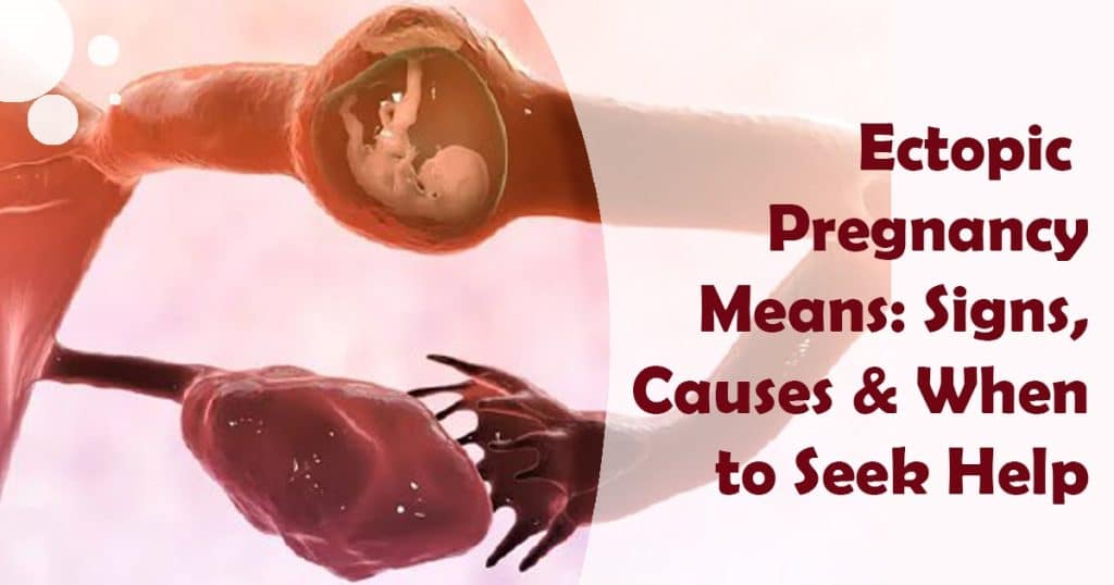 Ectopic Pregnancy