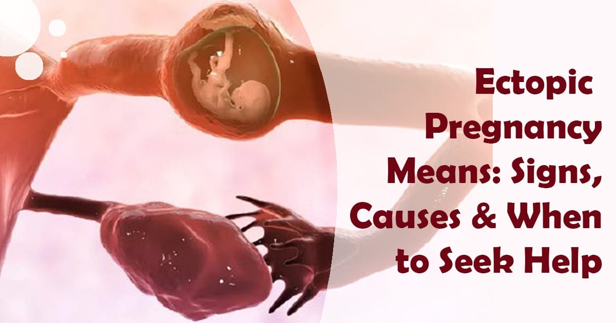 Ectopic Pregnancy