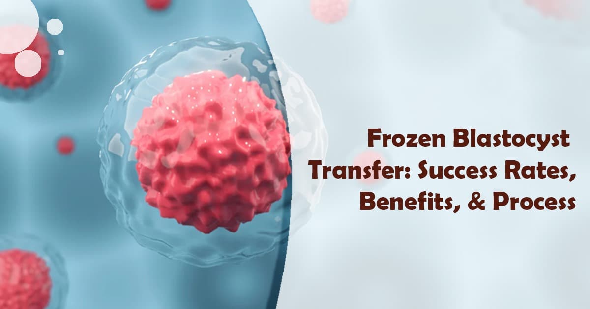 frozen blastocyst transfer