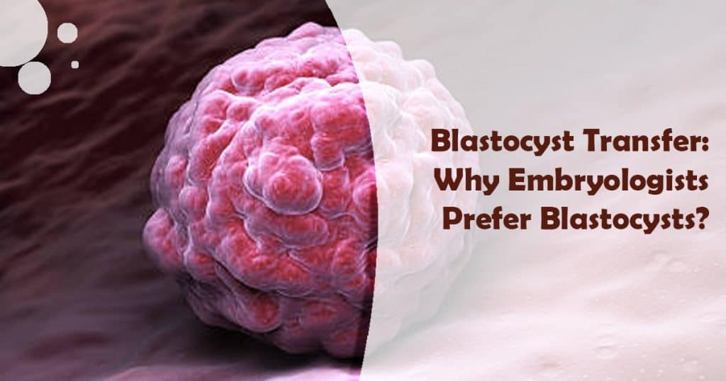 Blastocyst Transfer