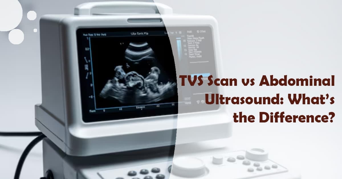 TVS scan vs abdominal ultrasound