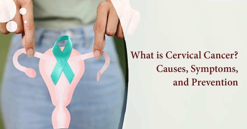 Cervical cancer