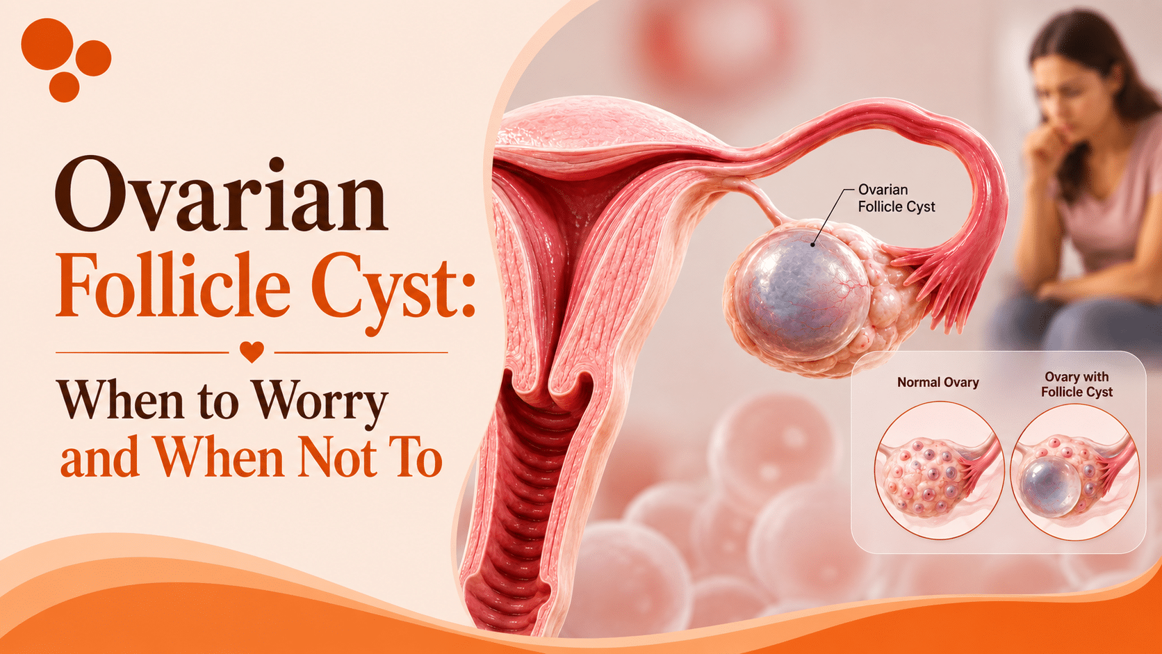 ovarian follicle cyst when to worry and when not to complete guide Risaa IVF Bulandshahr