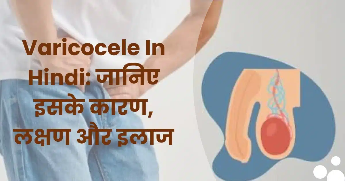 varicocele in hindi karan lakshan aur ilaj ki puri jankari Risaa IVF Pilibhit